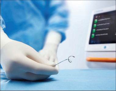  RDN | 經(jīng)腎動脈去交感神經(jīng)術(shù)&mdash;&mdash;高血壓微創(chuàng)介入治療